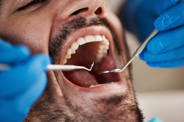 Best Broken or Chipped Tooth Repair in Mount Pleasant, MI